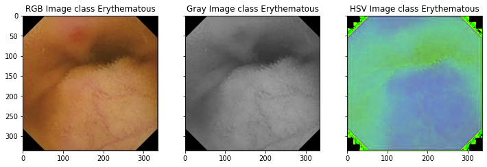 Erythematous