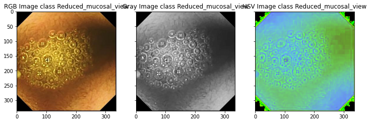Reduced_mucosal_view